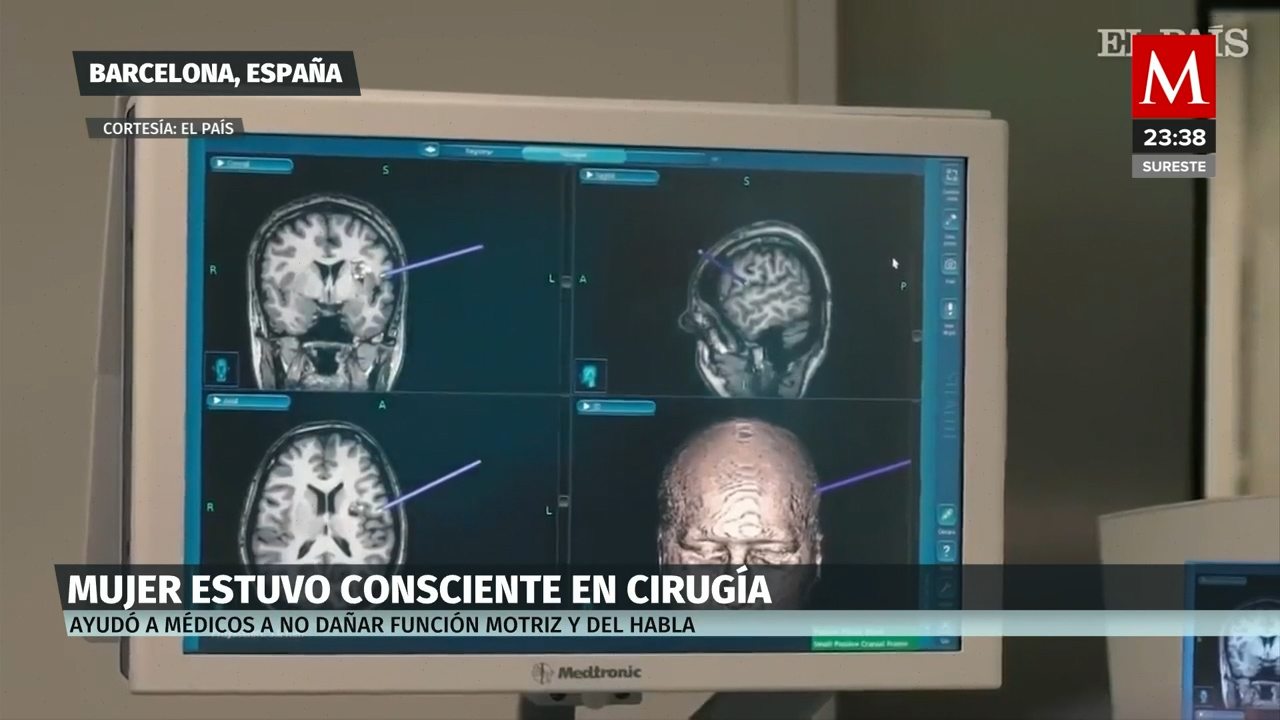 Una mujer es operada del cerebro despierta, para no perder sus 5 idiomas aprendidos