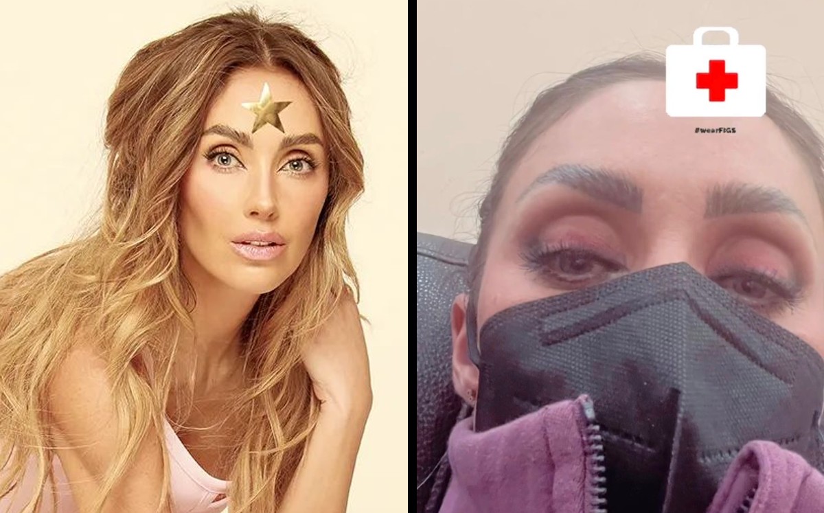 Anahí sufrió de un accidente que le perforó el tÍmpano | ESPECIAL