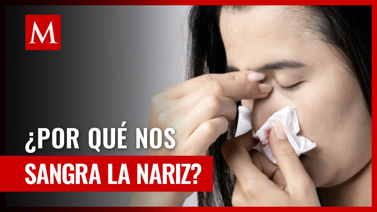 Hemorragia nasal: ¿Por qué ocurre durante el calor? Descubre la razón