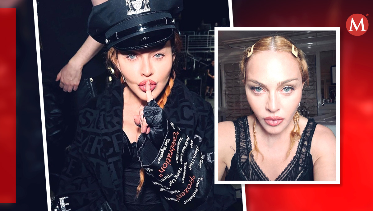 Madonna se encuentra en recuperación médica. | ESPECIAL