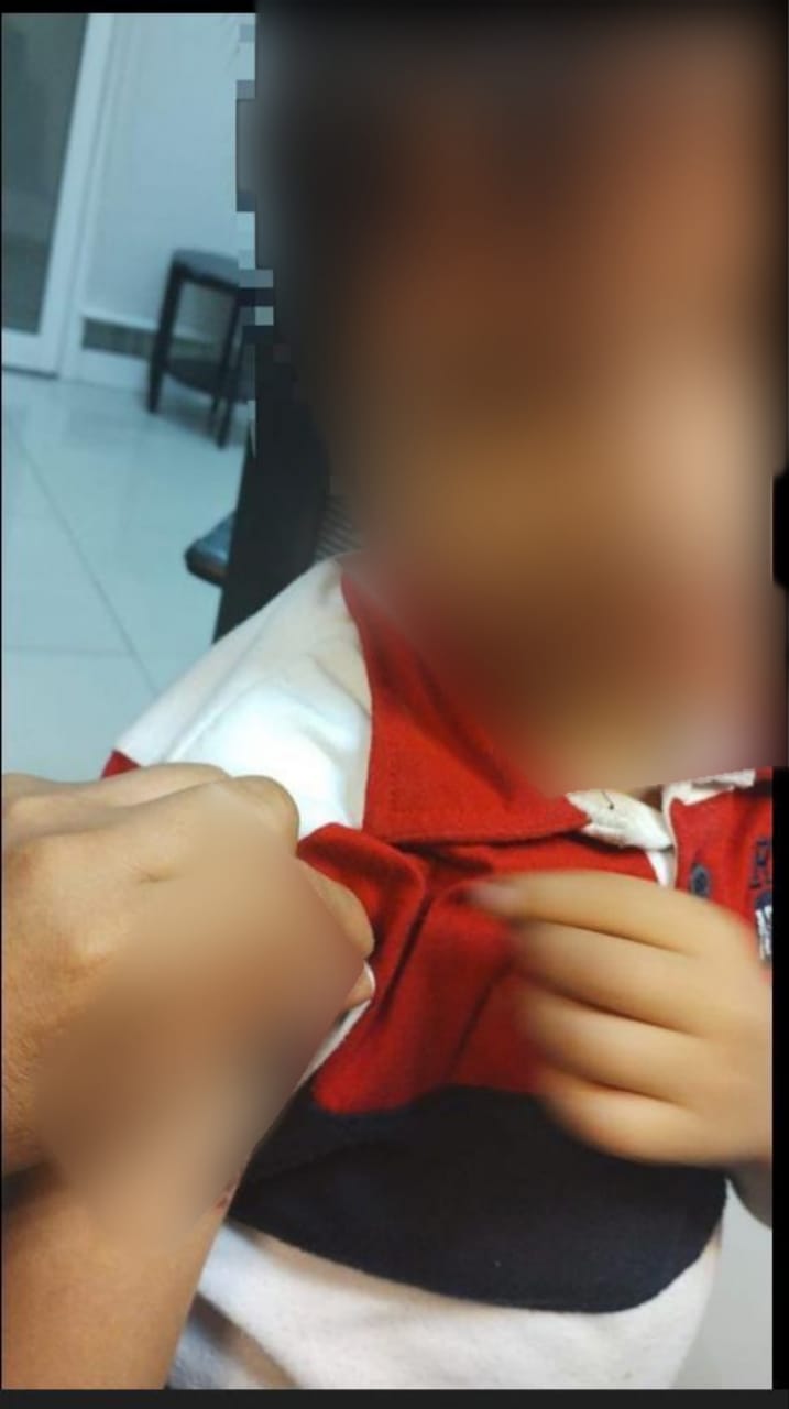 Fotografía de lesiones de menor