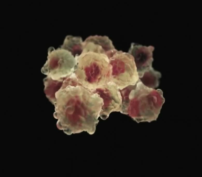 Investigadores de la Universidad de Miami avanzan en tratamiento de cáncer de próstata