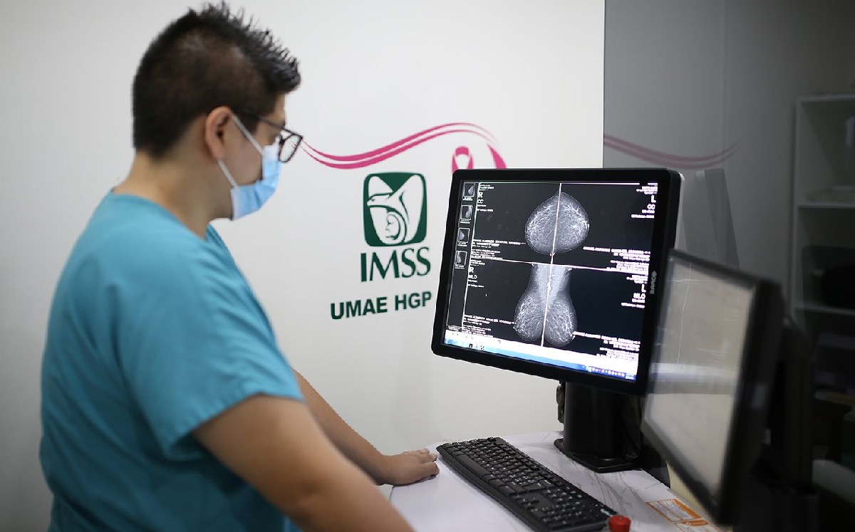 Cortesía | IMSS Guanajuato: Proyectan realizar 63 mil mastografías este 2023