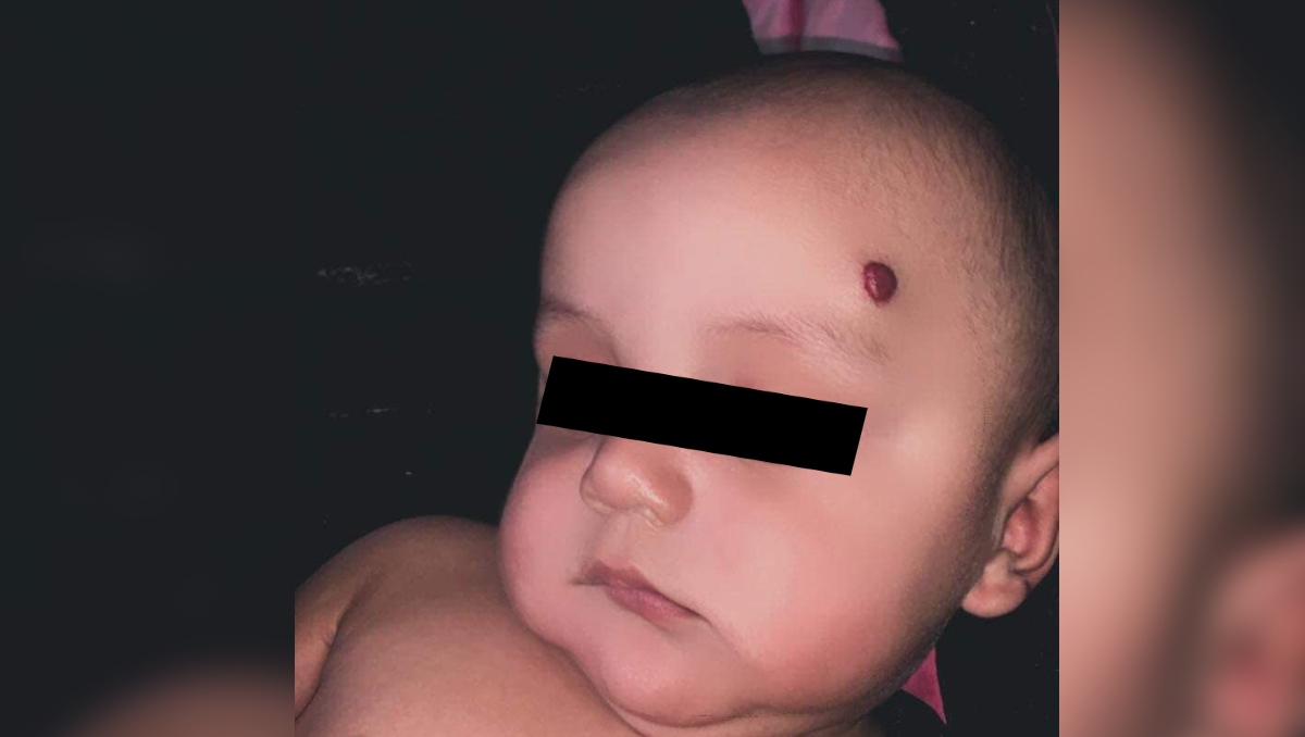Ángel Iván vive en Hermosillo, tiene nueve meses y un hermano gemelo. | Facebook