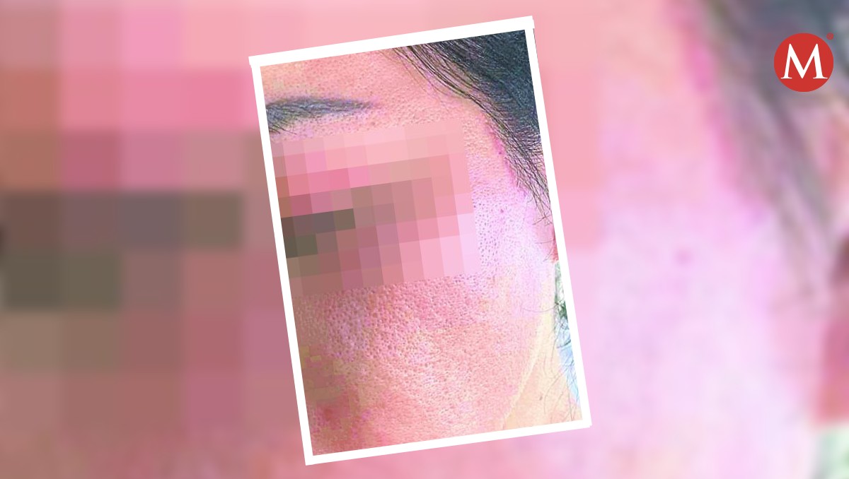 Mujer pide que muevan un coche y le responden con un golpe