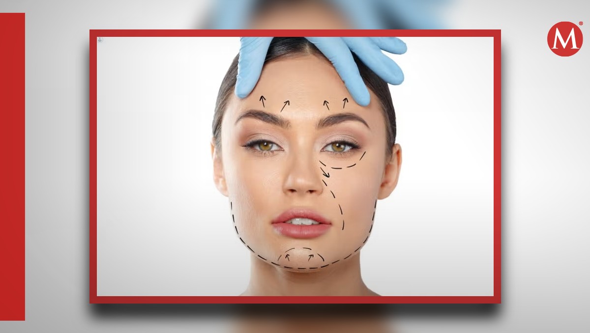 ¿Qué es la armonización facial?