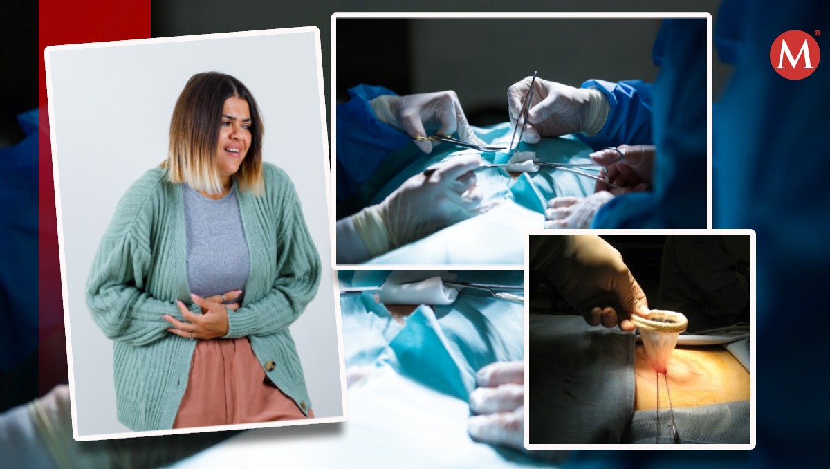 Un retractor AWR provoco dolores a la mujer por más de un año (Foto: Especial).