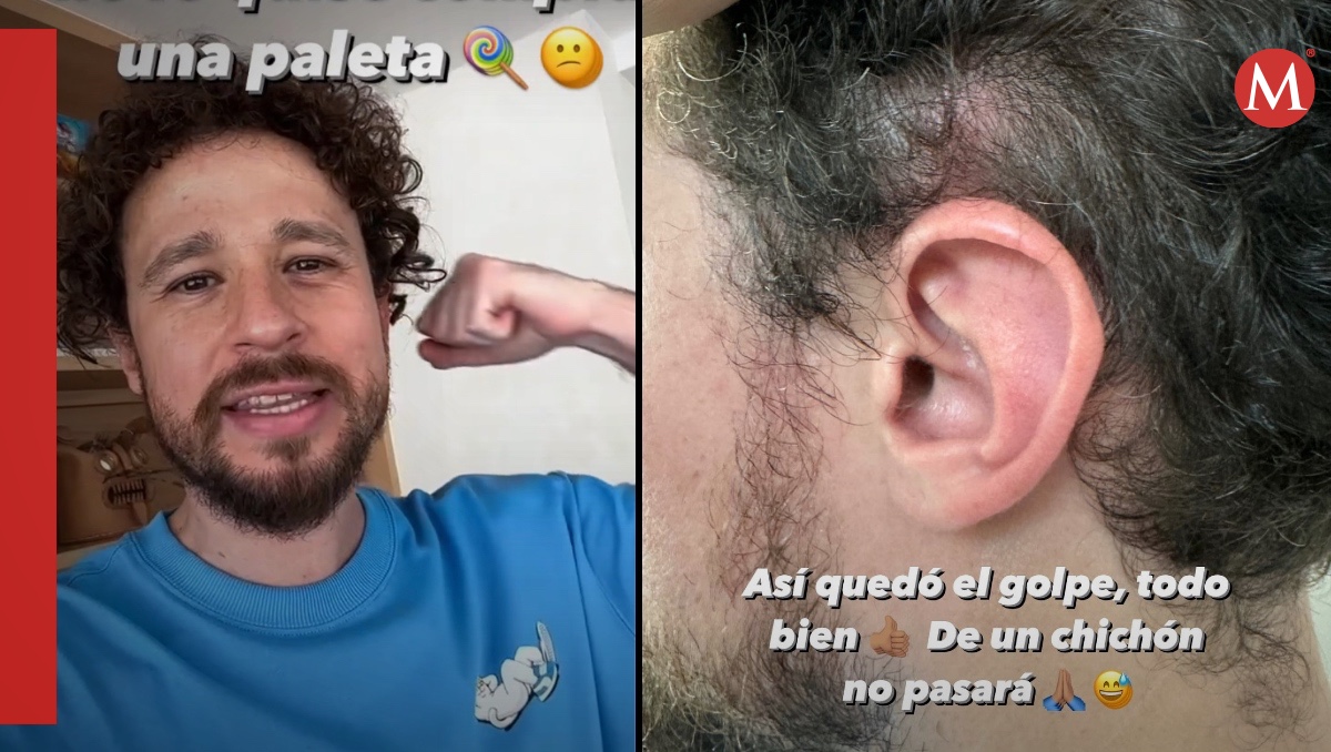 Luisito Comunica denuncia que un hombre en la calle lo golpeó | ESPECIAL