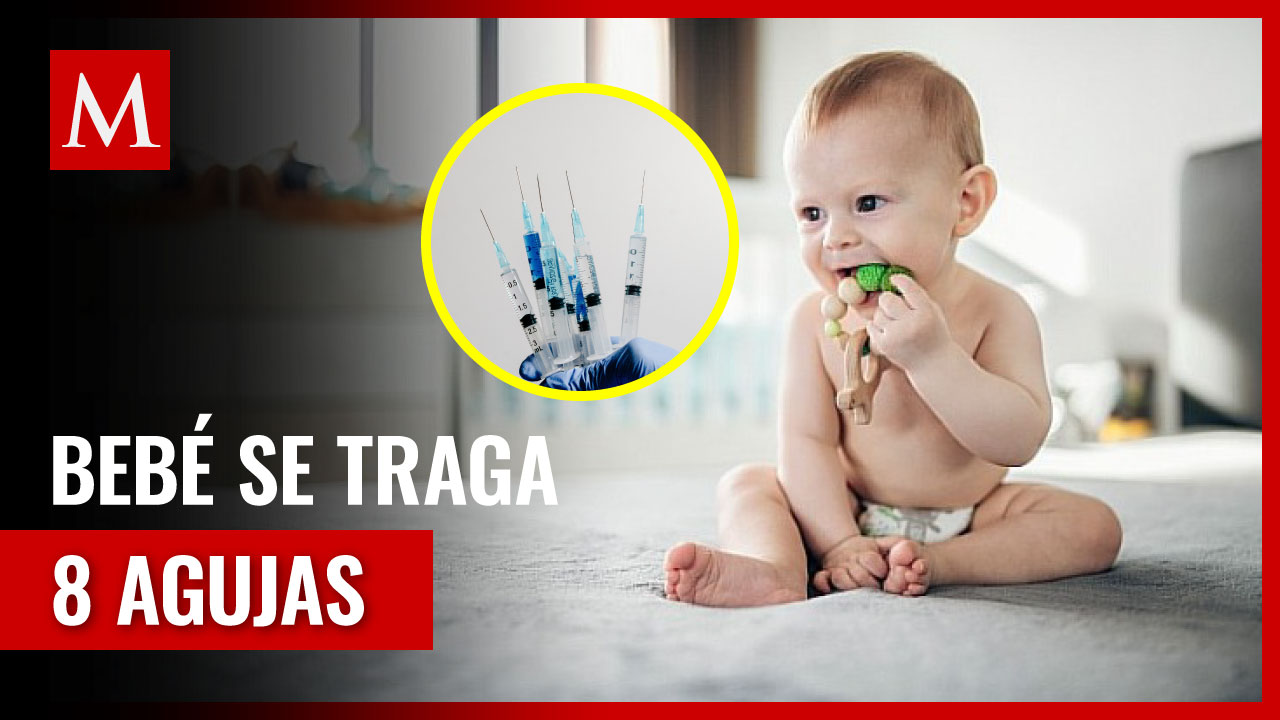 Bebé Sobrevive Tras Tragar Ocho Agujas en Perú