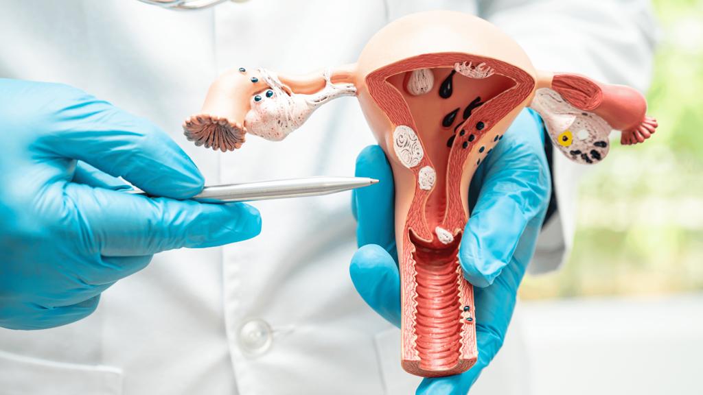 Más de 20 mil mujeres son diagnosticadas con algún tipo de cáncer ginecológico en México | Especial