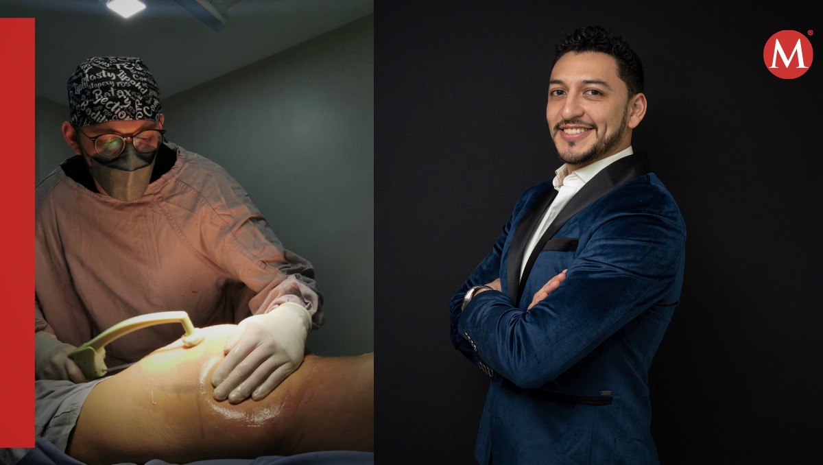Dr. Alex Hidalgo y la lipoescultura. / Especial