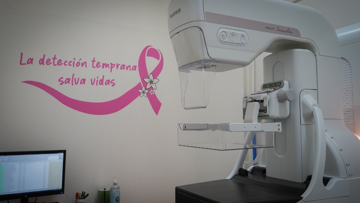 Conoce dónde solicitar las mastografías sin costo en Jalisco (Cortesía)