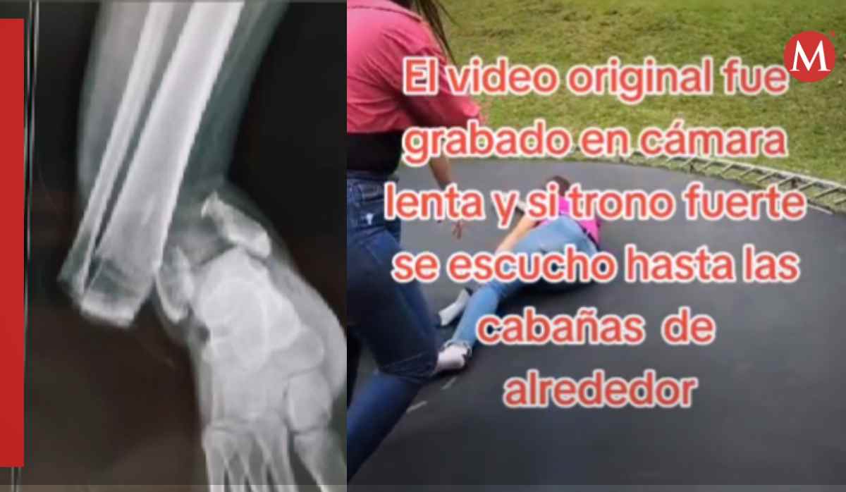 Mujer se fractura en trampolin | TikTok