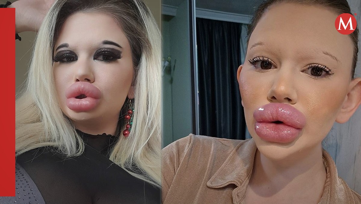 La mujer con los labios más grandes del planeta | Especial