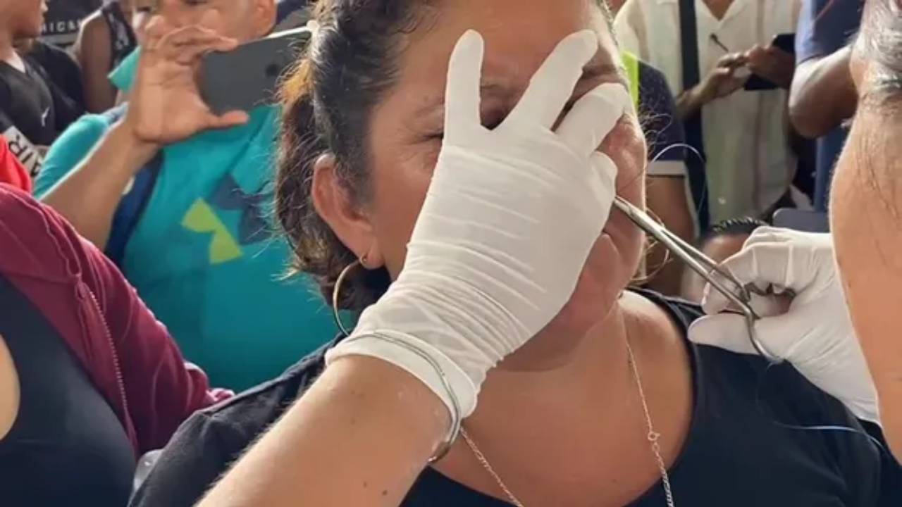 Migrantes en Chiapas cosen sus labios como protesta ante la falta de respuesta del INM
