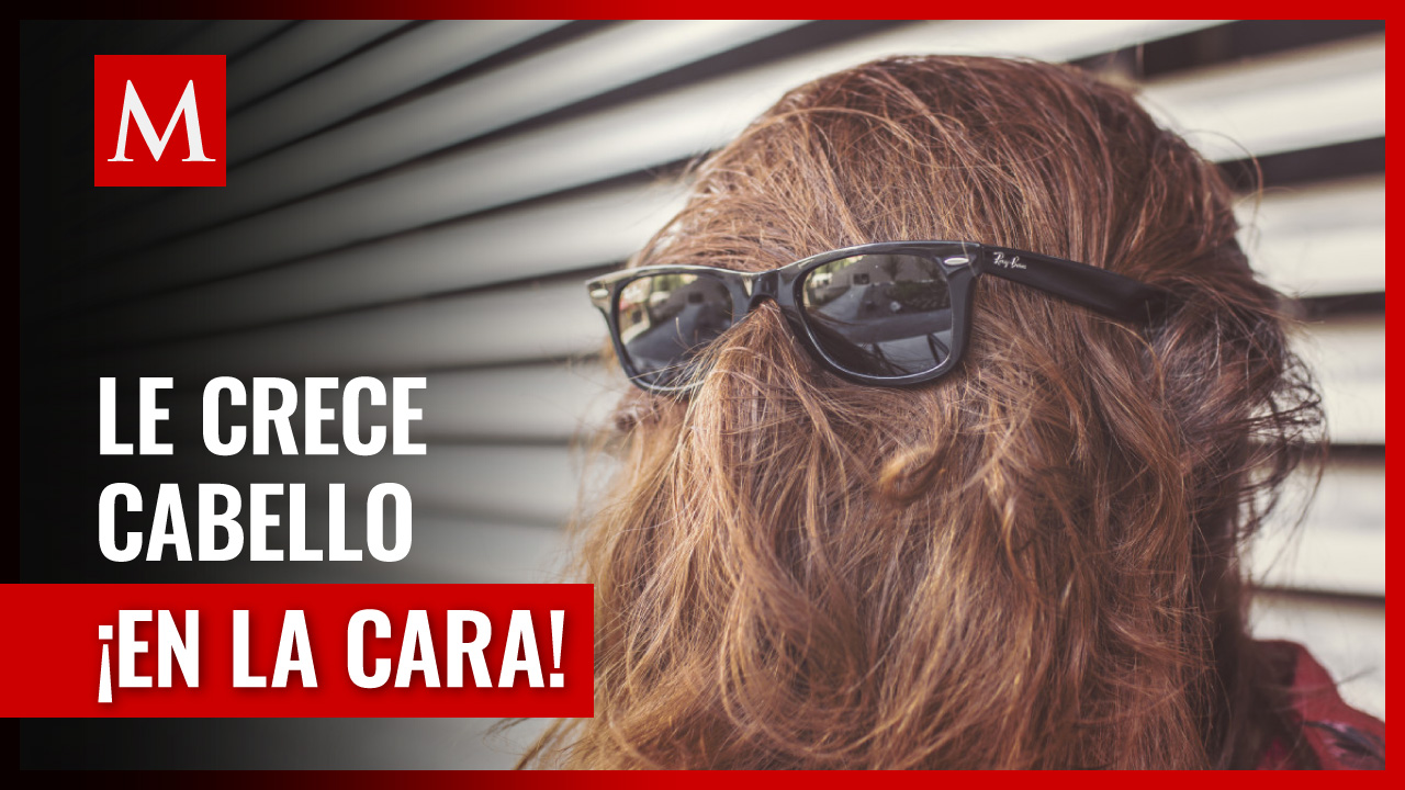 Niña con cabello en el rostro causa revuelo en redes