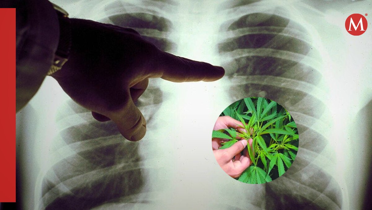 Consumidores de cánnabis tienen más riesgo de sufrir cáncer de pulmón