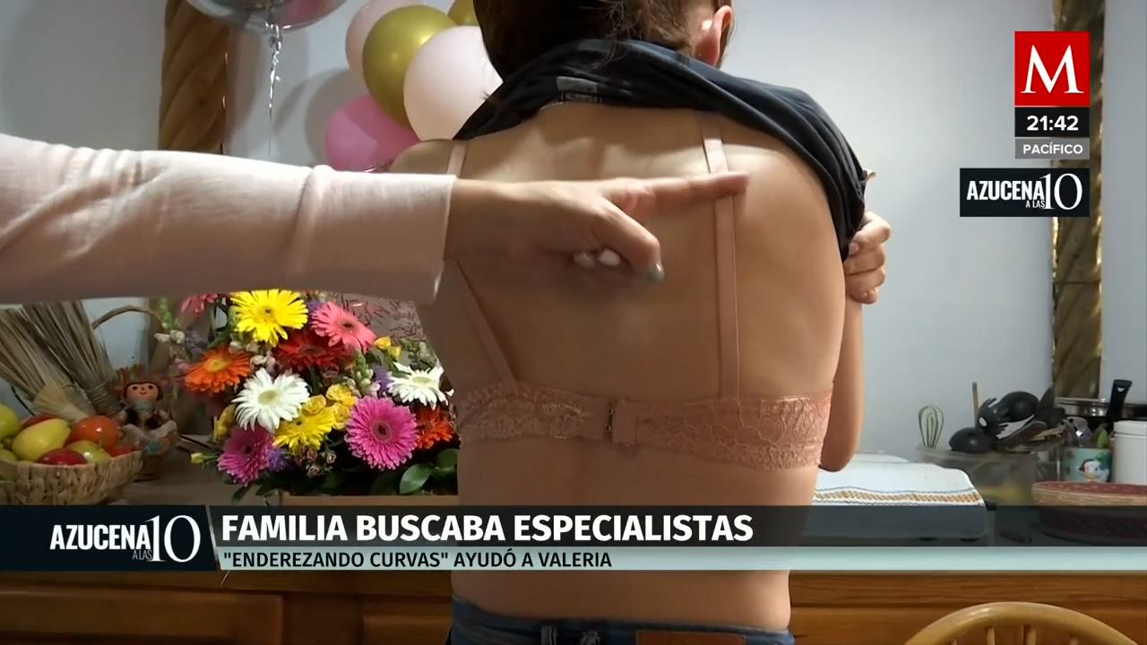 La fundación 'Enderezando Curvas' y las cirugías que cambian vidas
