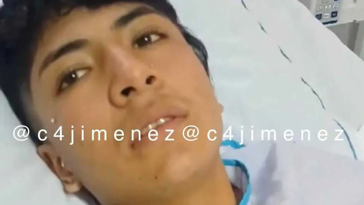 Cristian, joven quemado en una escuela mecánica de Texcoco, fue sometido a cirugía
