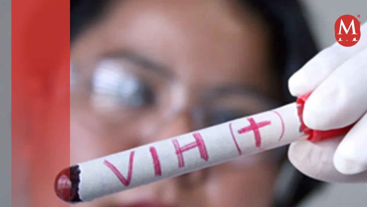 Detecta Salud 20 casos nuevos de VIH al mes en sur de Tamaulipas