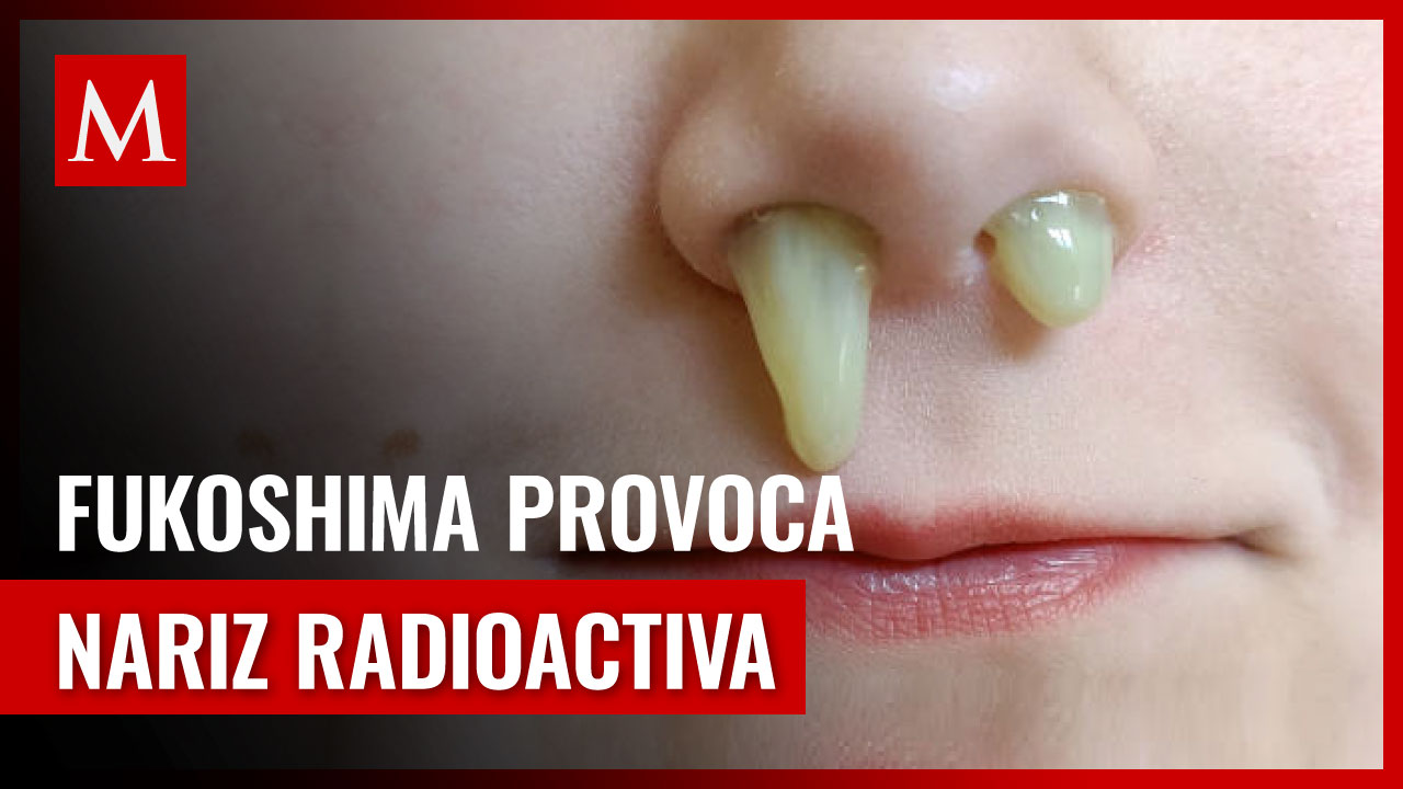 Trabajador de Fukushima presenta exposición de radiación