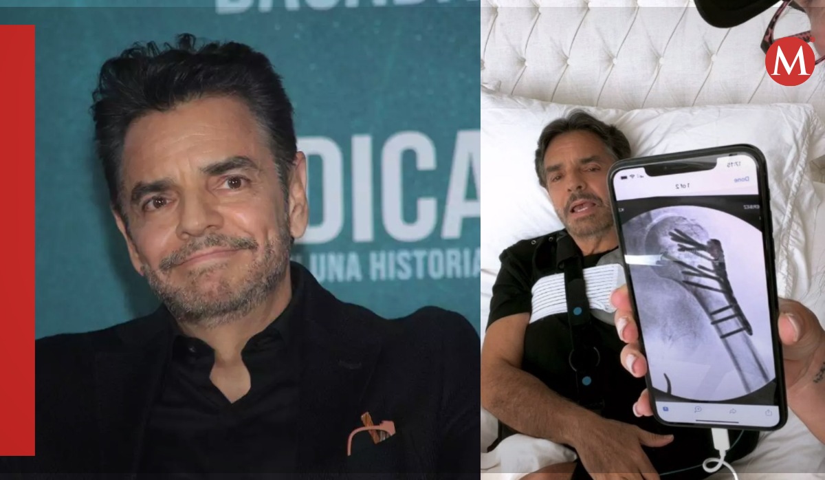 Eugenio Derbez recuerda lesión del hombro