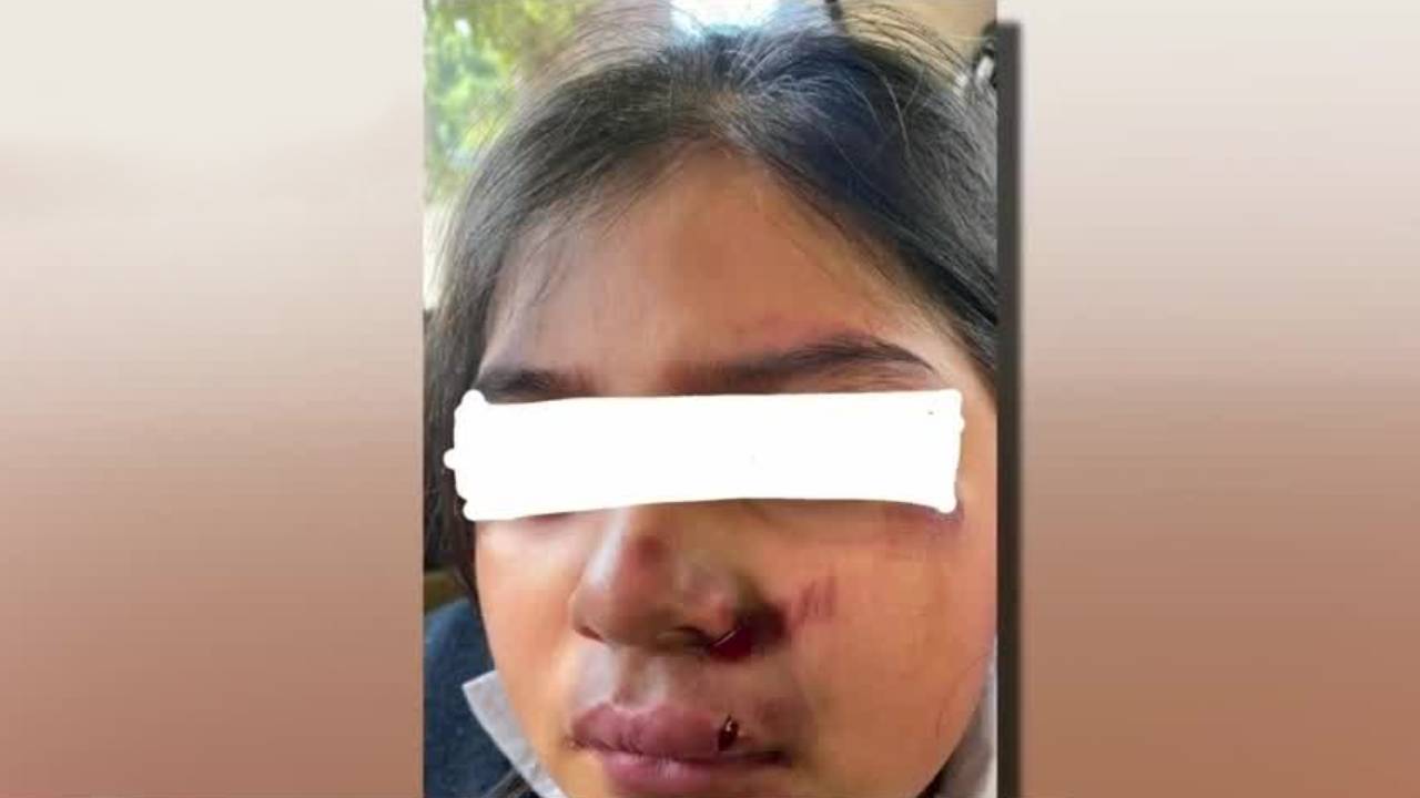 Defensoría de los Derechos Humanos de Oaxaca investigan caso de bullying