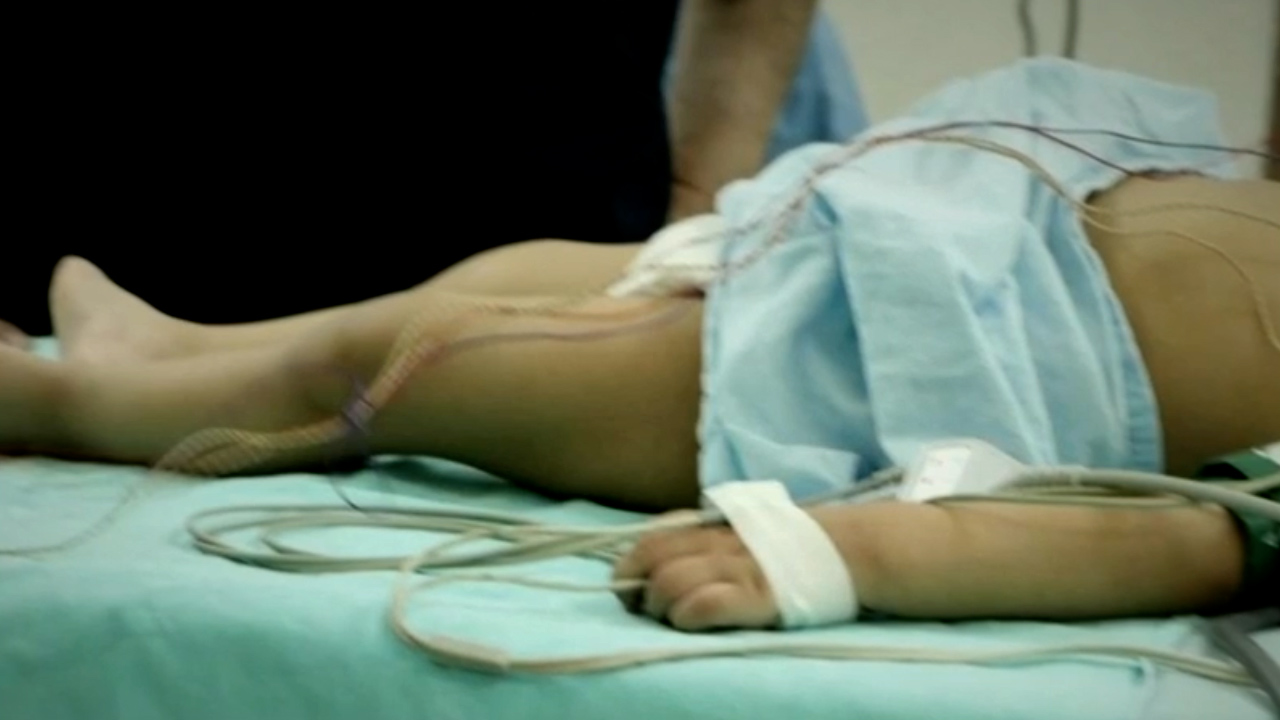 Reportan seis casos de niños intoxicados por metanfetaminas en Sinaloa