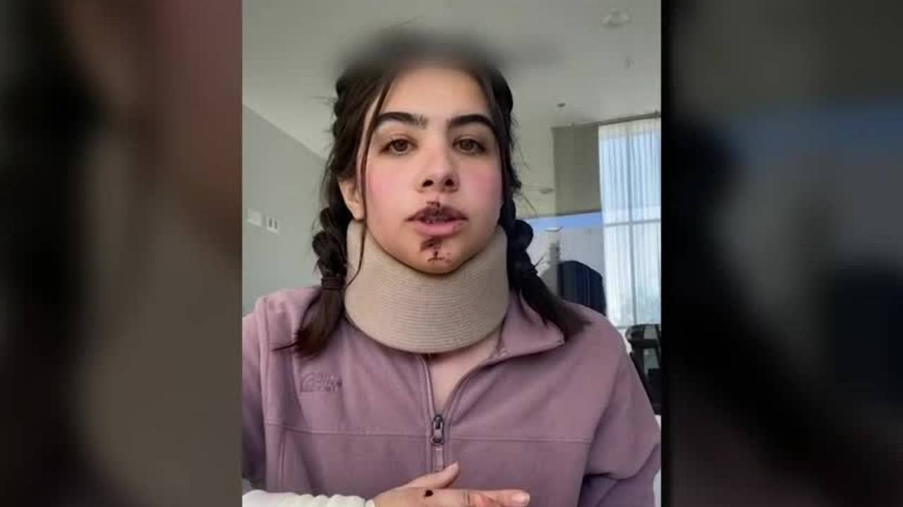 Ciclista herida demanda a las autoridades por mejores condiciones viales