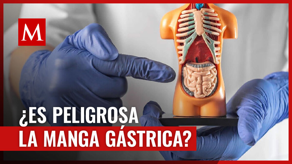 Así es el procedimiento quirúrgico por el que tiktoker de veinte años falleció