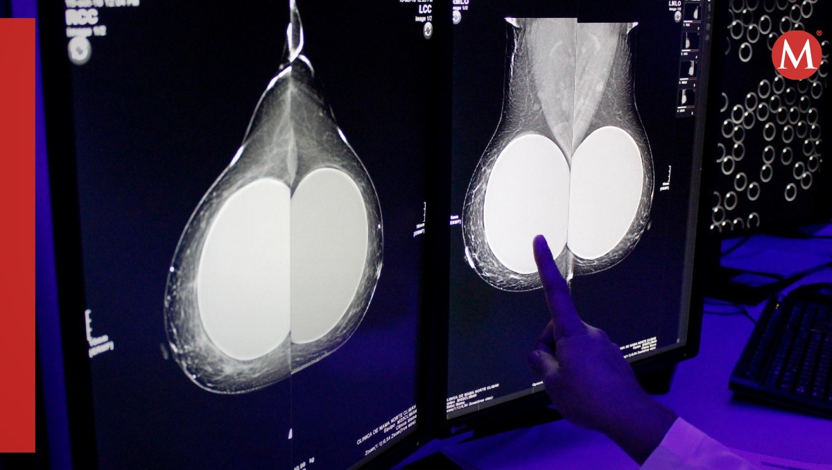 Los casos de cáncer van en aumento | FOTO: IMSS/CUARTOSCURO