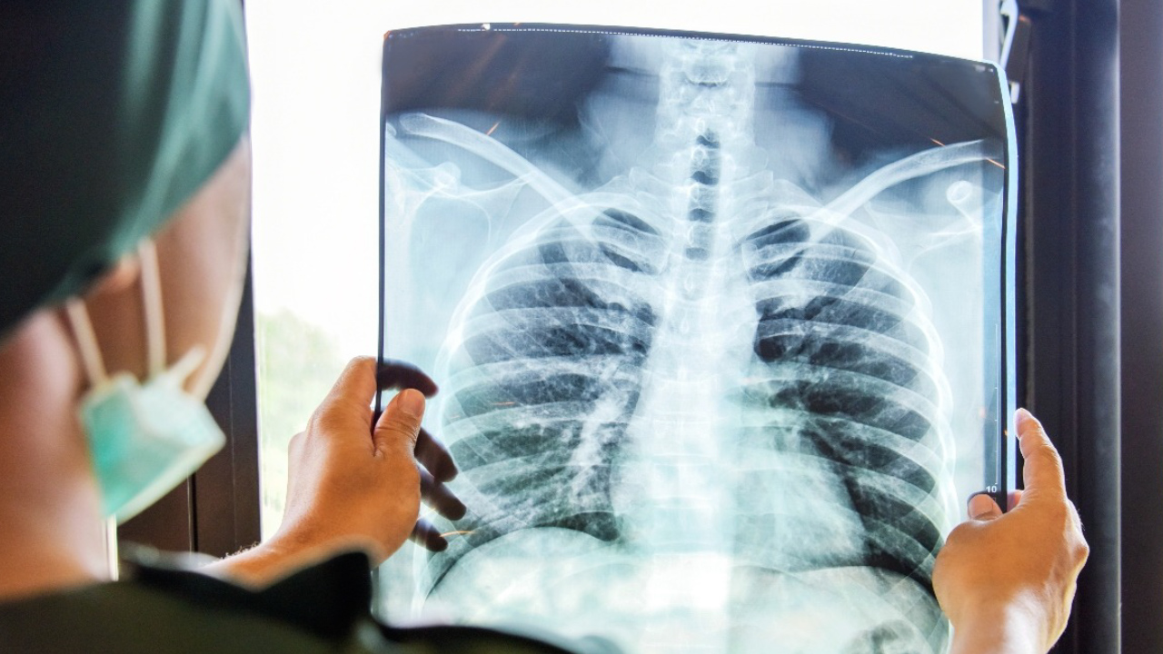 ¿Cuál es el procedimiento para detectar un cáncer?