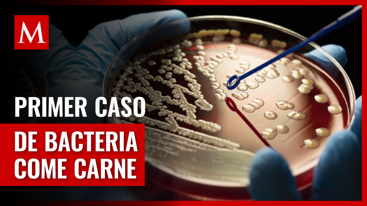 Descubren primer caso de la bacteria come carne en España