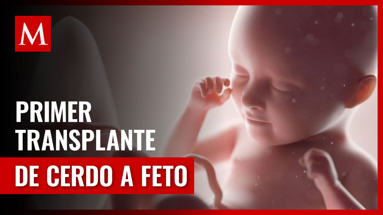 Médicos japonés preparan el primer transplante de riñón de cerdo a bebé nonato
