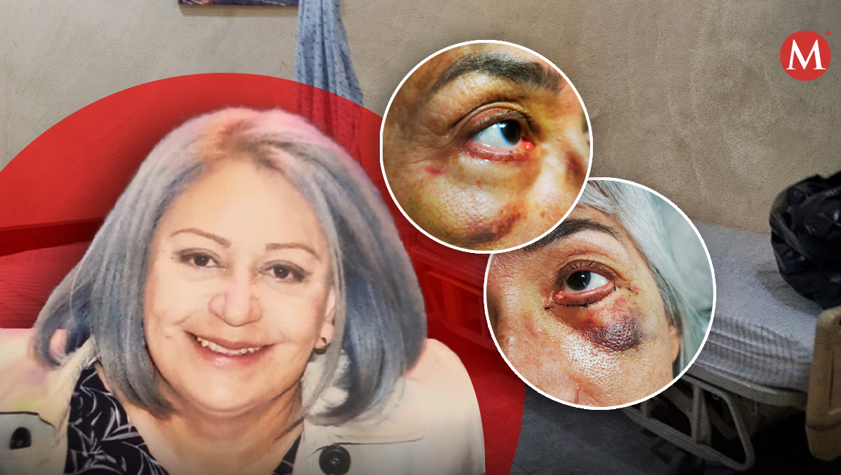 Enfermeras y amas de casa realizan cirugías plásticas en Chihuahua.