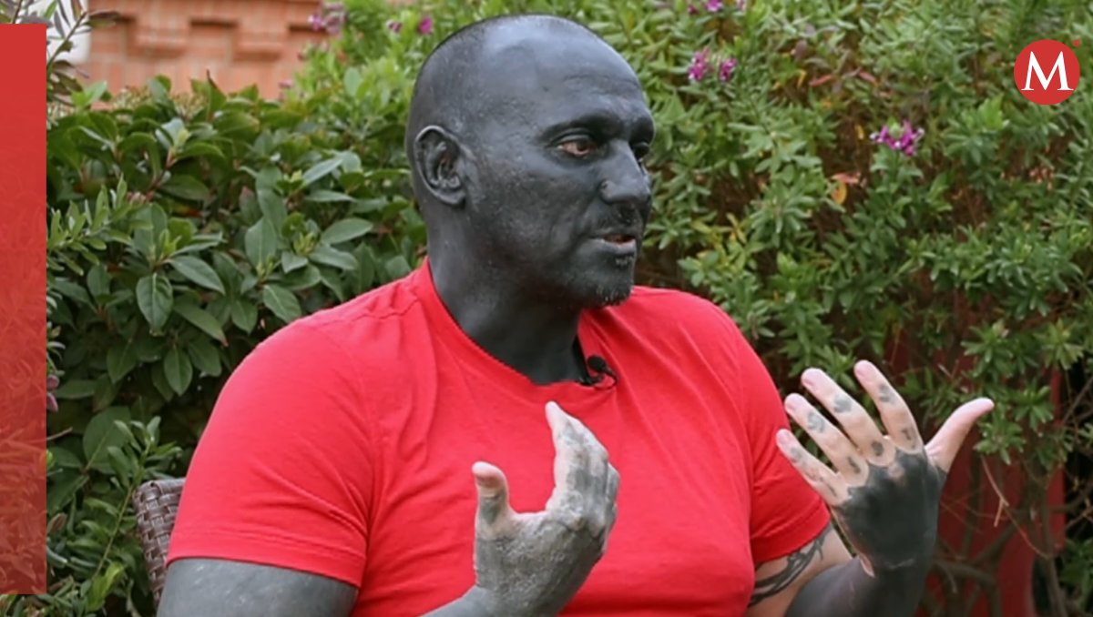 Roma Blackout recibe burlas por su tatuaje | Especial