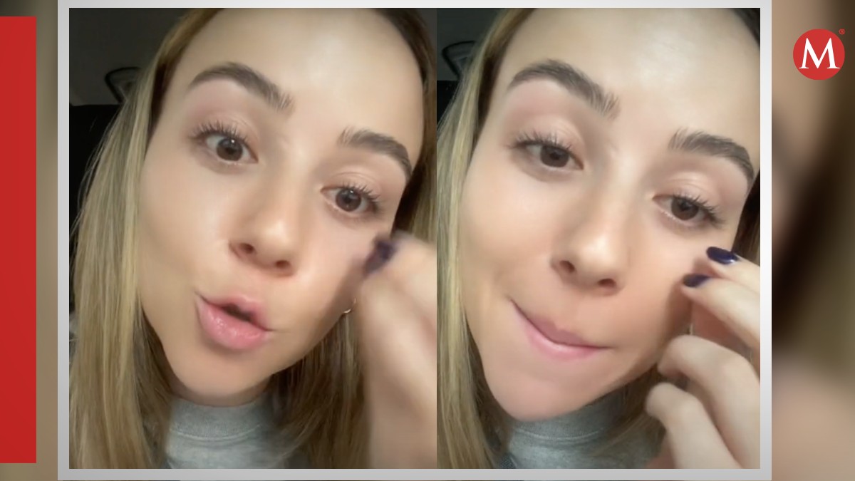 Mujer tenía un gusano en el ojo y así lo supo. | ESPECIAL