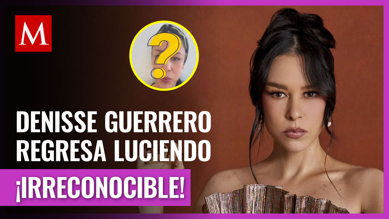 Denisse Guerrero, vocalista de Belanova, preocupa por el aspecto de su rostro