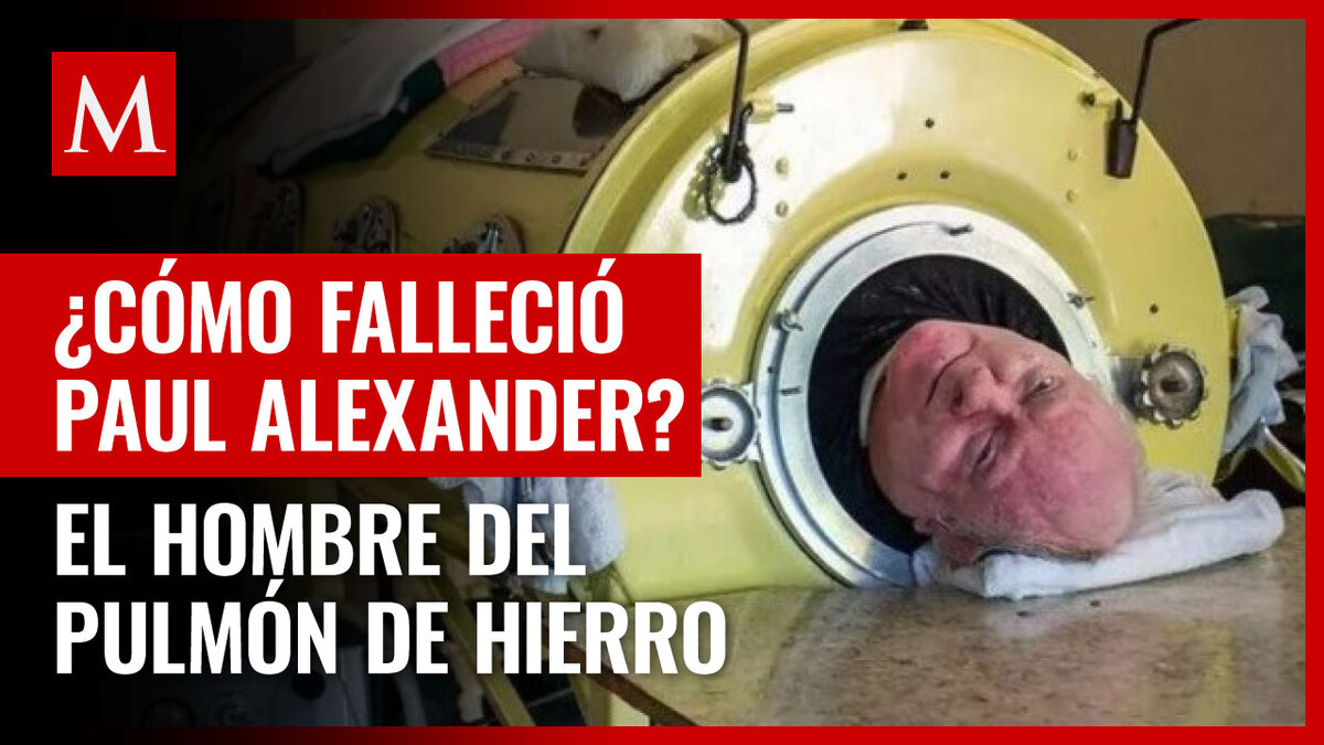 Muerte de Paul Alexander: ¿Causada por COVID-19 o su pulmón de hierro?