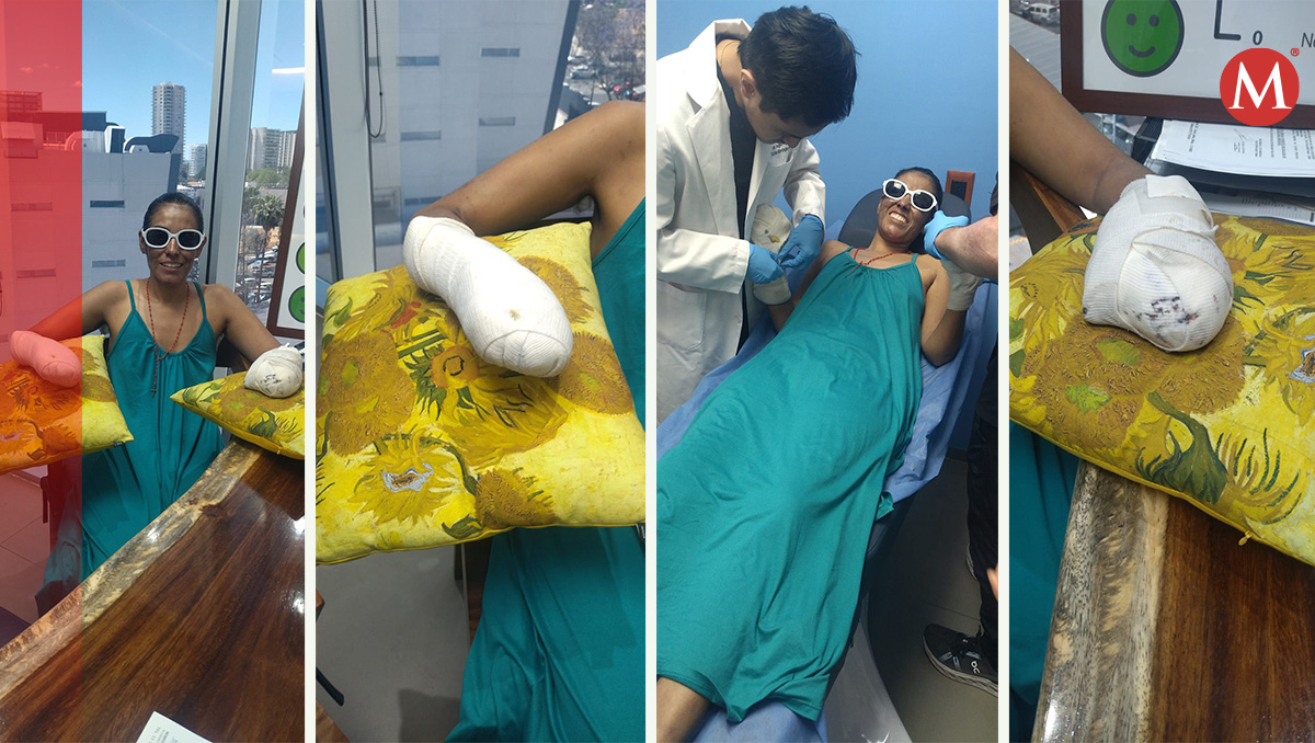 Continúa avanzando la recuperación de Andrea tras rescate del Pico de Orizaba en Puebla (Diana Barajas)