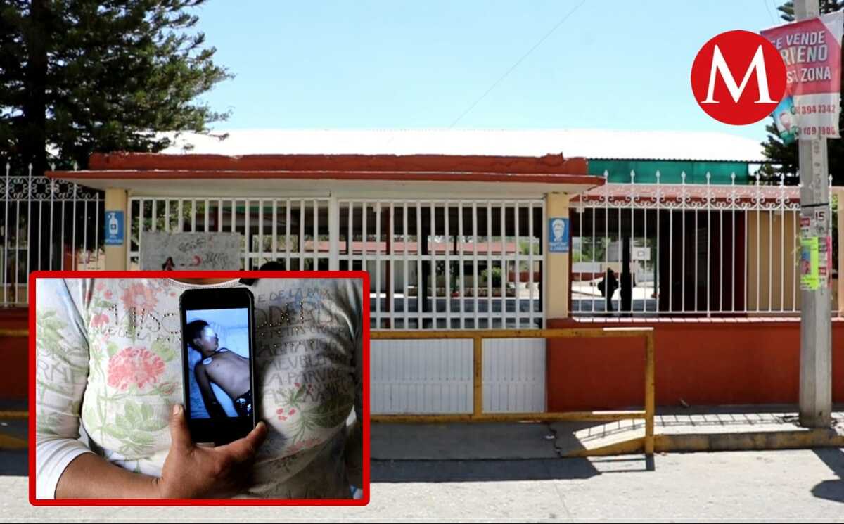 Miguel necesita una segunda operación tras lesiones sufridas en su escuela.