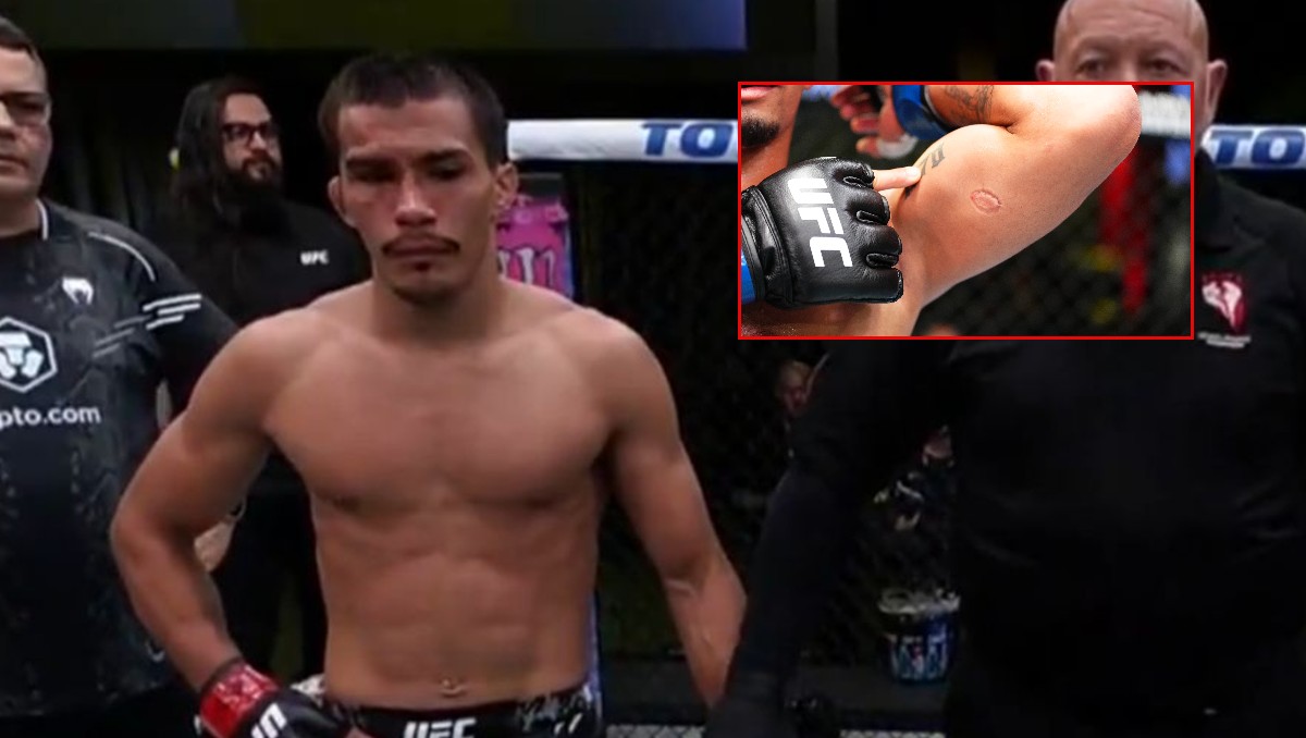 Igor Serevino es descalificado por morder a rival en UFC Fight Night (Captura de pantalla Fox Sports/@UFCEspañol)