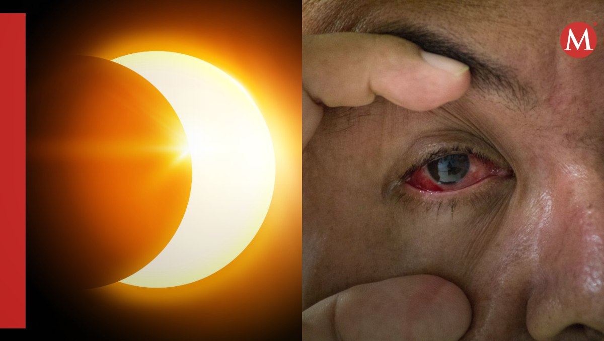 "¿Por qué me duelen los ojos"? aumenta en Google tras eclipse