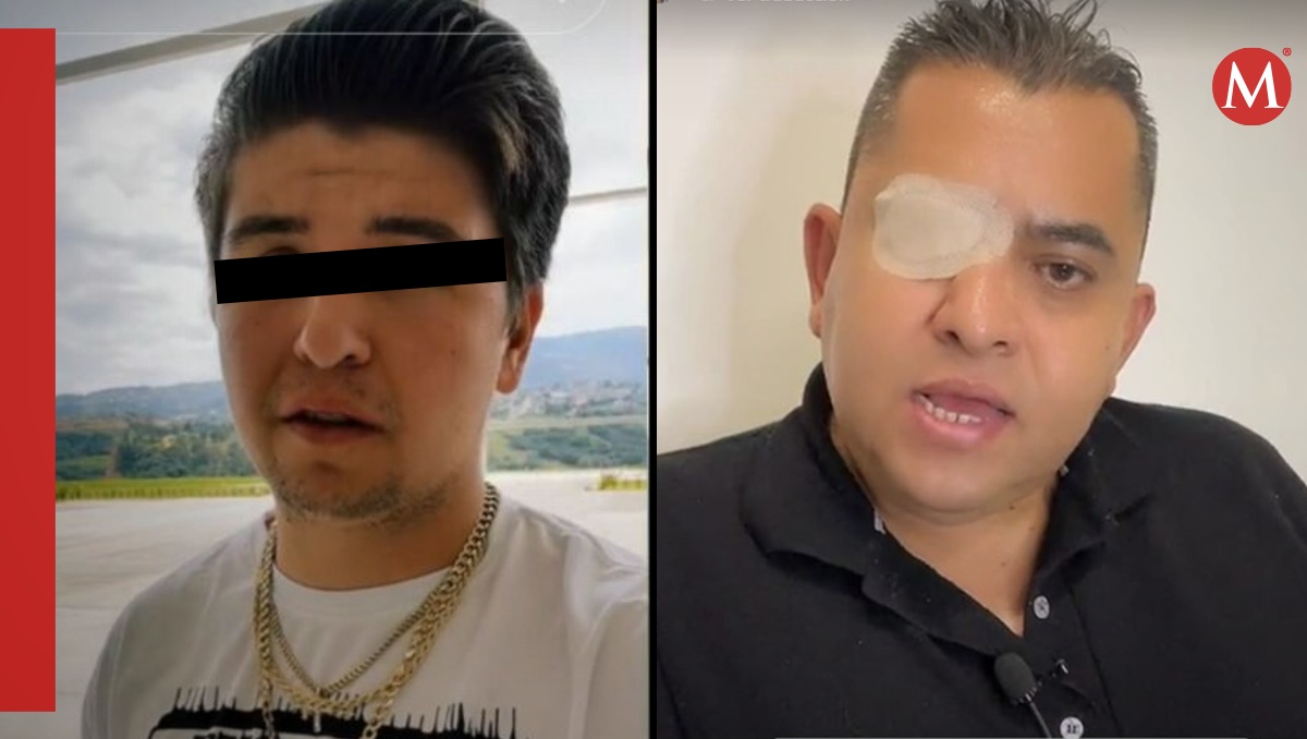 Escolta asegura que perdió su ojo por culpa de Fofo Márquez | ESPECIAL