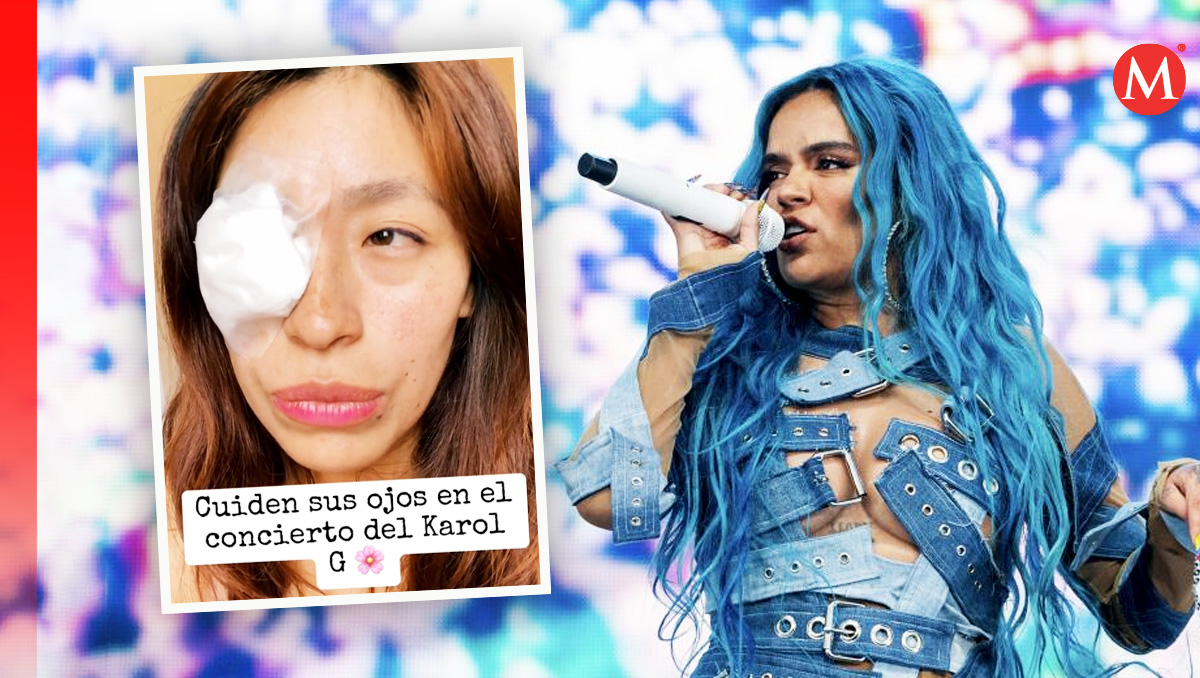 Joven sufre lesión en el ojo durante concierto de Karol G. (Foto: Especial)