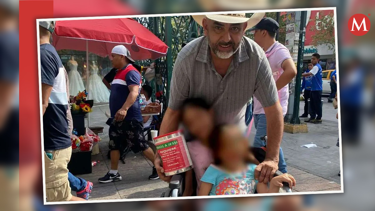 El padre de Jessi dejó de trabajar por las complicaciones presentadas  | Especial