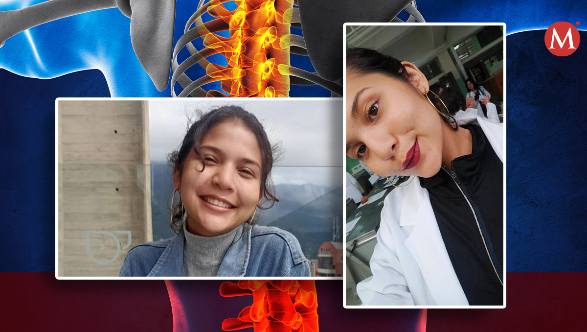 Estudiante revela cómo se enteró que tenía Esclerosis Múltiple.