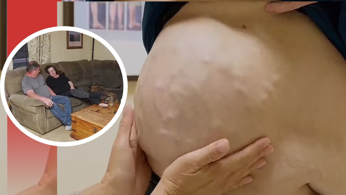 Mujer revela que un tumor grande le impidió estar con su novio. | Especial