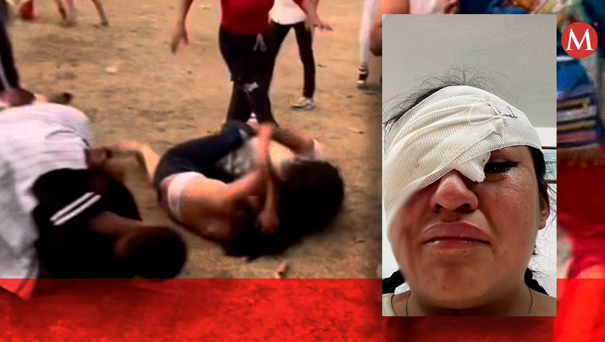 Mujer pierde ojo tras golpiza en Puebla | Especial