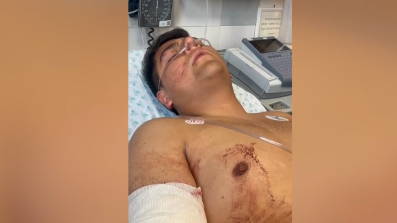 Atacan a balazos a hijo de candidato a presidente municipal de Metepec, Edomex